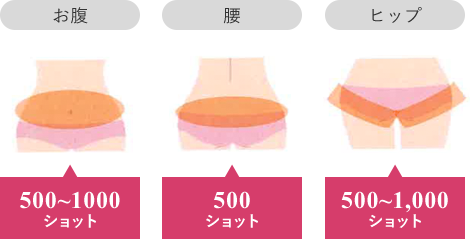 お腹:500~1000 ショット 腰:500 ショット ヒップ:500~1,000 ショット 