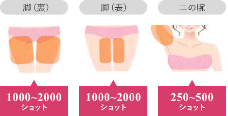 脚(裏）:1000~2000 ショット 脚(表）:1000~2000 ショット 二の腕:250~500 ショット 